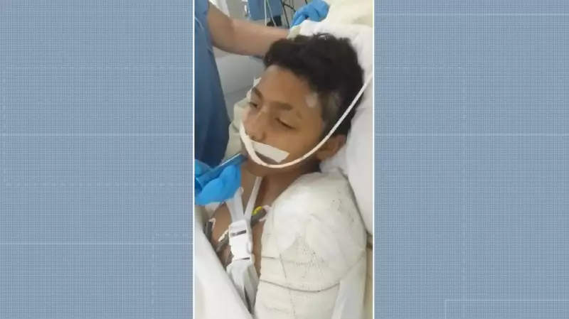 Adolescente atropelado por motorista embriagado e sem CNH em Campinas deixa UTI e se recupera bem, diz avó