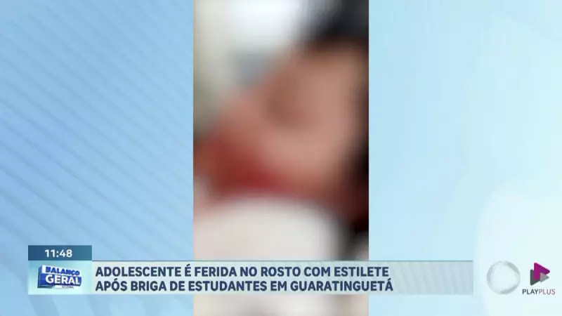 Adolescente é atacada com estilete no Vale do Paraíba: veja detalhes da briga