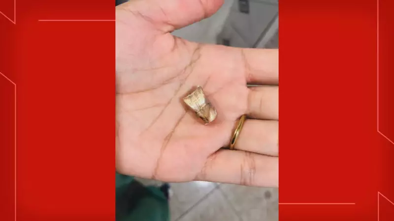 Bala perdida atinge homem dentro de casa no DF: veja detalhes do incidente