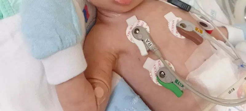 Bebê com síndrome de Down aguarda há 10 dias por vaga em UTI em Belém: entenda o caso