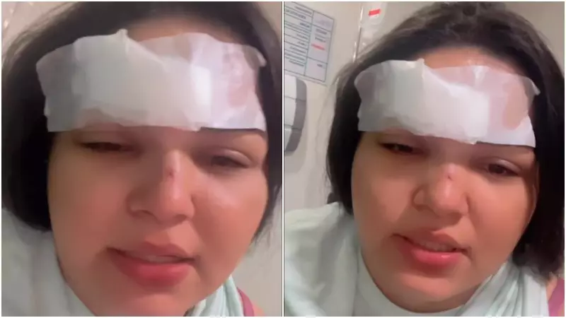 Cantora sofre corte no rosto após briga por ciúmes com golpe de garrafa no Ceará
