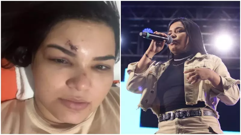 Cantora tem testa cortada com garrafa em ataque violento no Ceará: 'Não entendi o motivo'