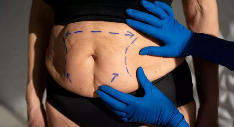 Cirurgia bariátrica ainda é indicada mesmo com avanço de novos medicamentos