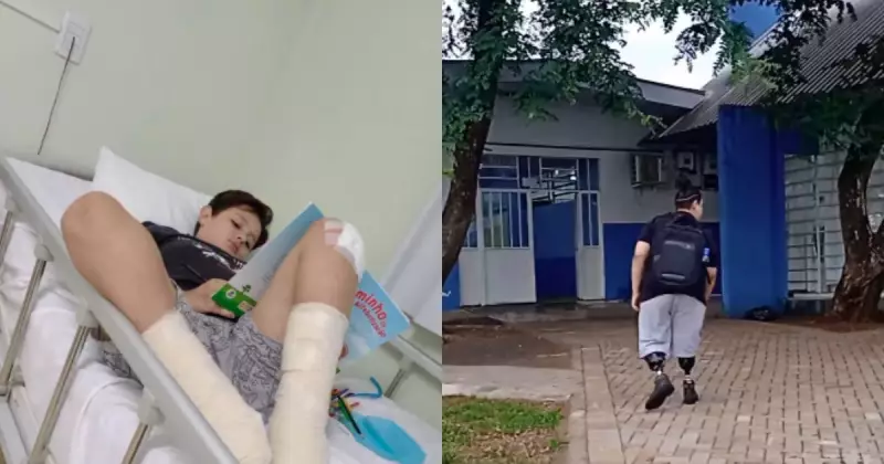 Criança do Paraná perde as duas pernas após infecção generalizada causada por queda de skate