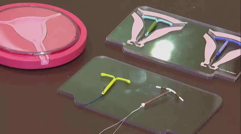 DIU gratuito: Interior da Bahia oferece método contraceptivo de longa duração
