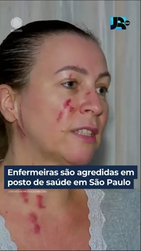 Enfermeiras sofrem agressão em posto de saúde de São Paulo: violência contra profissionais da saúde preocupa