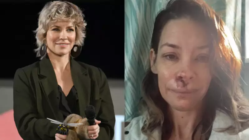 Evangeline Lilly, estrela de 'Lost', sofre acidente na praia e choca fãs