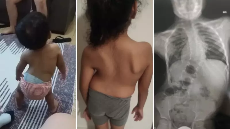 Faxineira corre contra o tempo para salvar filha com grave problema na coluna