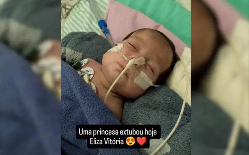 Gêmeas de Manaus passam por cirurgia de separação em Goiânia: uma delas é extubada com sucesso
