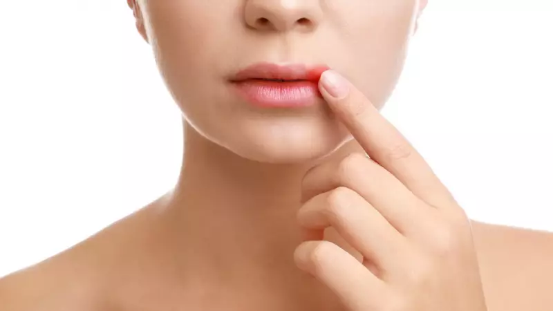 Herpes labial pode aumentar risco de Alzheimer, revela estudo inédito