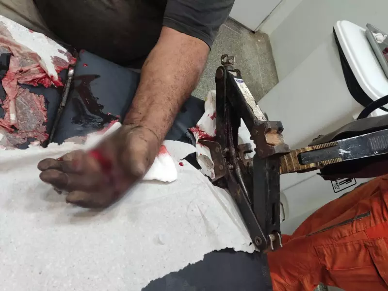 Homem fica com a mão presa em máquina de brinquedo e é resgatado por bombeiros na Bahia
