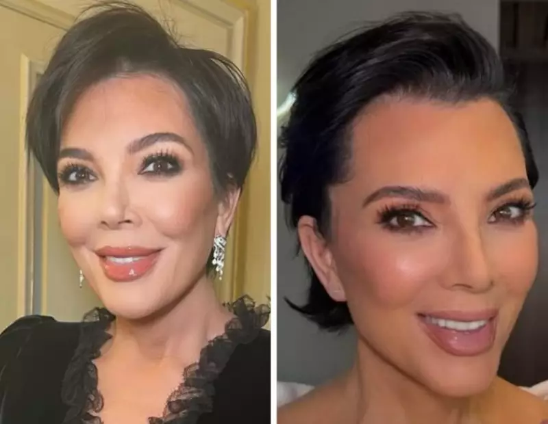 Kris Jenner: O Segredo Por Trás do Seu Rejuvenescimento Impressionante