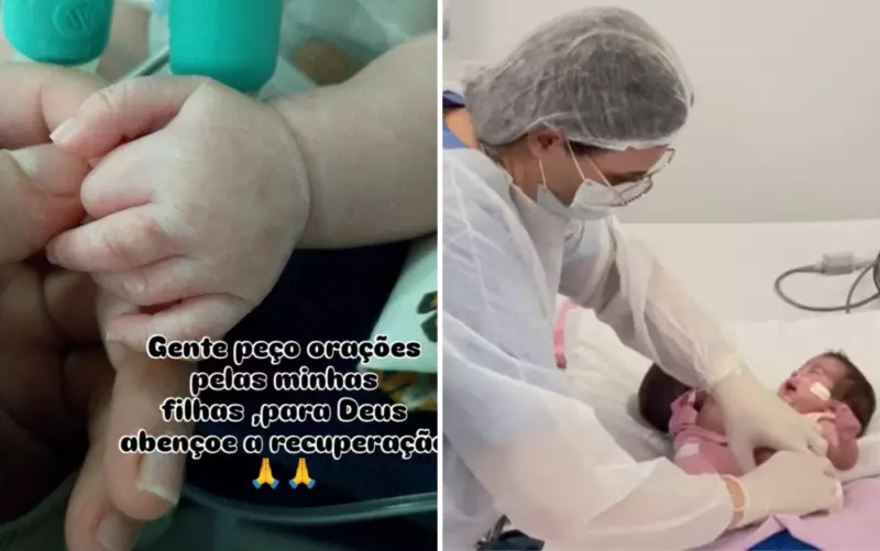 Mãe de gêmeas siamesas de Manaus pede orações após cirurgia de separação bem-sucedida