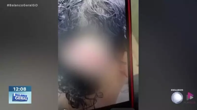 Marido usa cola permanente para esconder agressão à esposa em Goiás — caso choca polícia