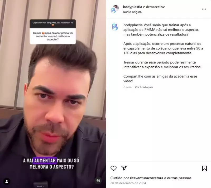 Médico teve lucro como agravante em inquérito sobre morte após harmonização de bumbum no Recife