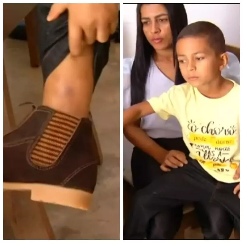 Menino sobrevive a picada de jararaca ao fechar portão em Tocantins: história de coragem e sorte