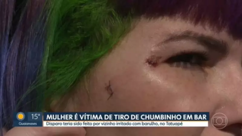Mulher é atingida por bala de chumbinho em bar de SP; tiro partiu de prédio vizinho