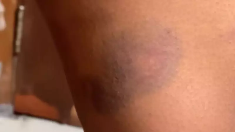 Mulher é resgatada após dois dias de agressões e ameaças do companheiro em Uberlândia