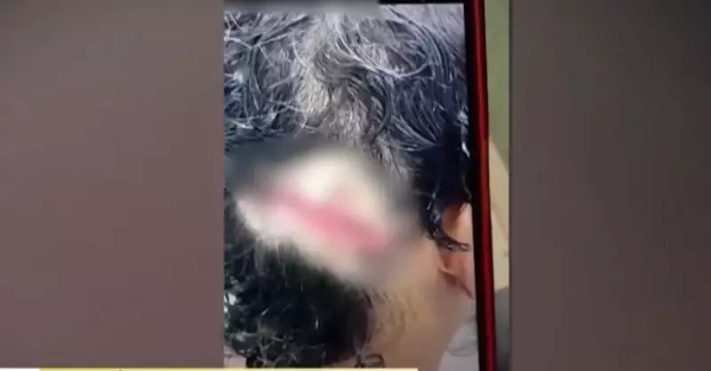 Mulher é torturada e tem cabeça colada com cola permanente pelo próprio marido em Goiás