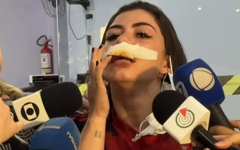 Mulher retira queixa contra cantor de forró após agressão em Manaus: 'Ele corria risco na prisão'