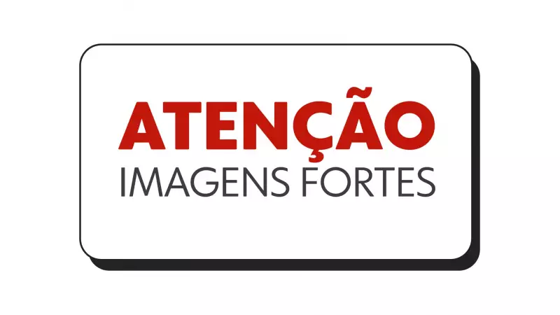 Mulher tem lábio reconstruído após ataque de cachorro em Santa Catarina