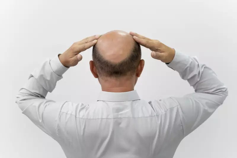 Queda de cabelo: descubra o que realmente funciona e os mitos que você deve ignorar