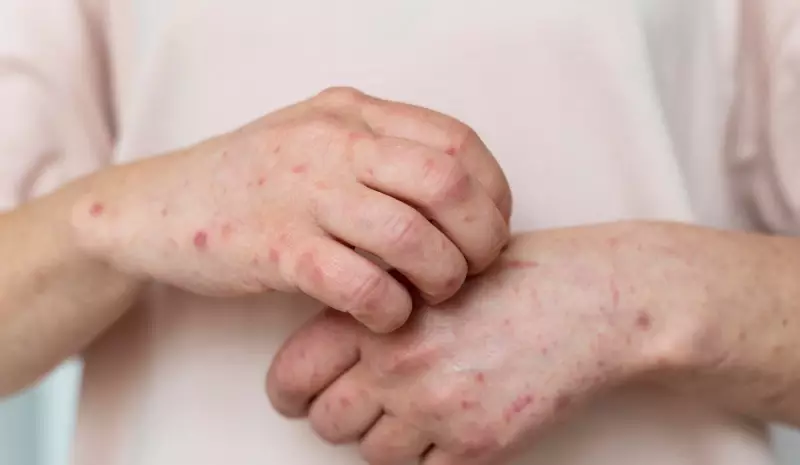Sarampo: como se proteger de uma das doenças mais contagiosas do mundo