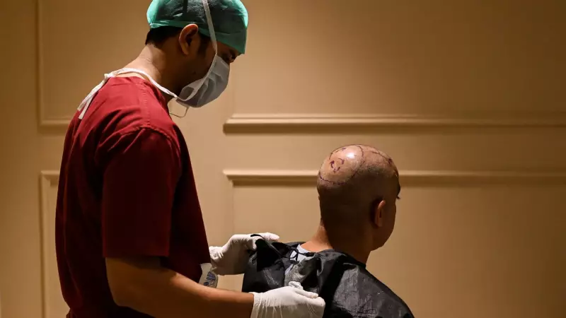 Tragédia em clínica de transplante capilar: homens morrem após procedimento realizado por dentista