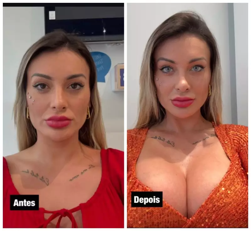 Andressa Urach relata dor e medo de cegueira após cirurgia para mudar cor dos olhos: entenda os riscos