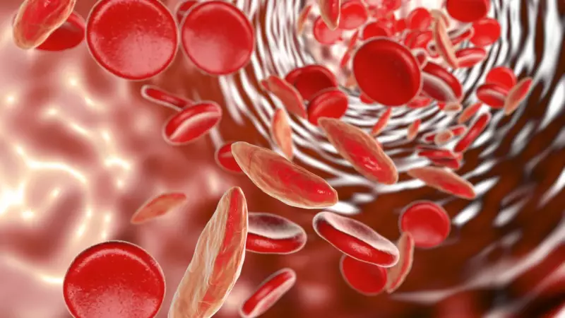 Anemia Falciforme: Sintomas, Causas e Tratamento - Tudo o que Você Precisa Saber