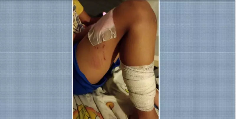 Ataque de Pitbull deixa crianças feridas em condomínio de Monte Mor: saiba detalhes