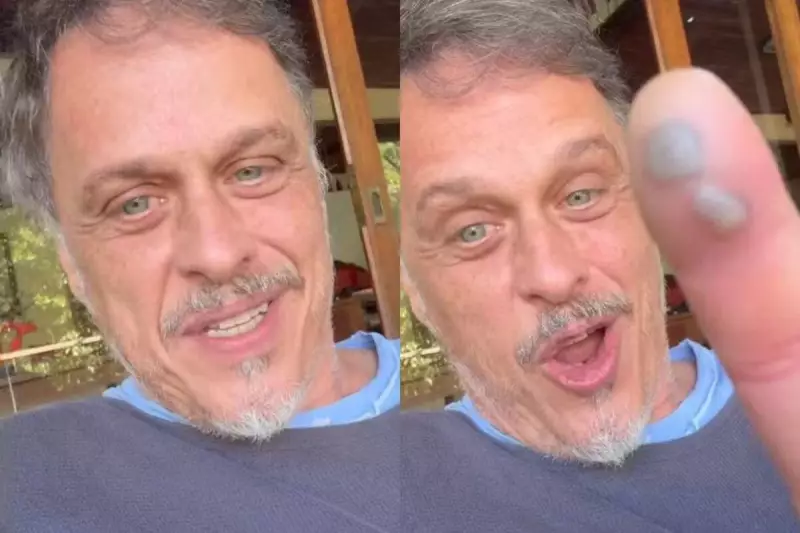 Ator Guilherme Fontes sofre picada de jararaca e relata dor intensa: 'Não sei explicar'