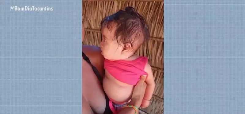 Bebê indígena morre em hospital do Tocantins após espera por vaga na UTI: tragédia expõe falhas no sistema de saúde