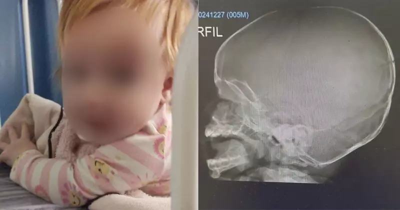 Bebê sofre fratura no crânio após cair de trocador em creche de SC: família acusa omissão