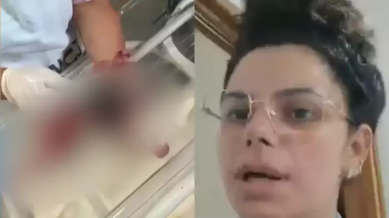 Bebê sofre queimaduras graves após banho em maternidade de MG: "Pele começou a sair", relata tia
