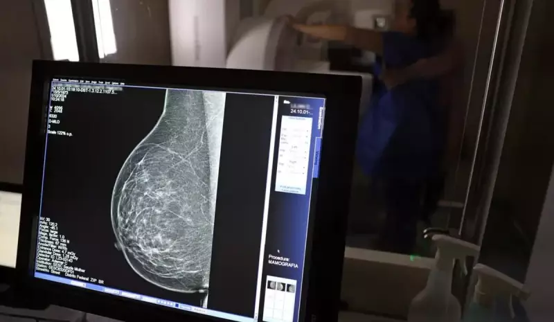 Câncer de Mama: 1 em cada 3 pacientes tem menos de 50 anos no ES