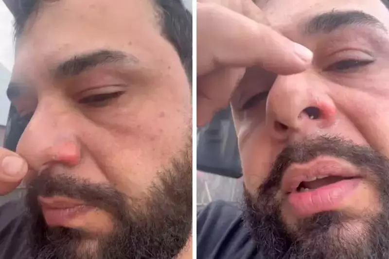 Cantor sertanejo sofre queimaduras durante show: vídeo impressionante!
