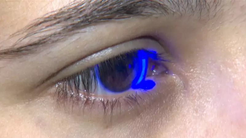 Ceratocone: médico revela como prevenir e tratar essa doença ocular que afeta milhares de brasileiros