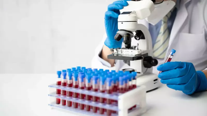 Cientistas franceses descobrem novo tipo sanguíneo em mulher caribenha: entenda a importância