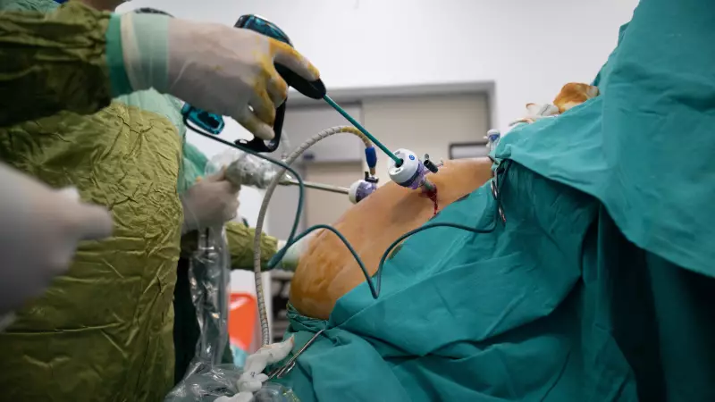 Cirurgia bariátrica no SUS: CFM amplia critérios, mas apenas 10% dos procedimentos são realizados