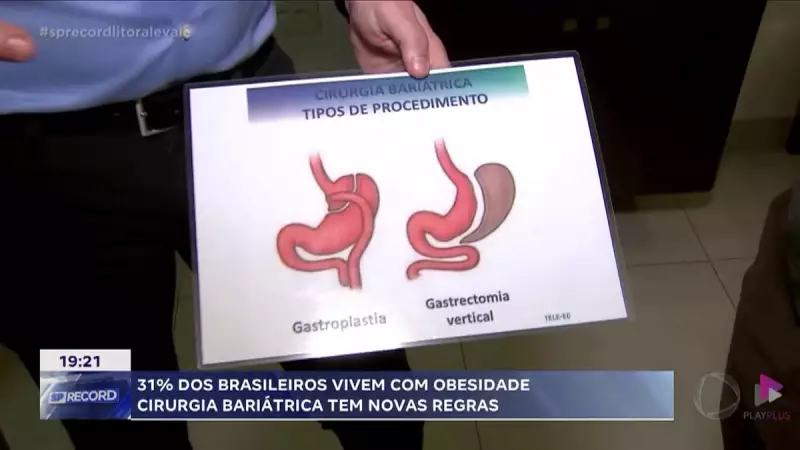 Cirurgia Bariátrica: Transformando Vidas e Promovendo Acesso à Saúde no Litoral Paulista