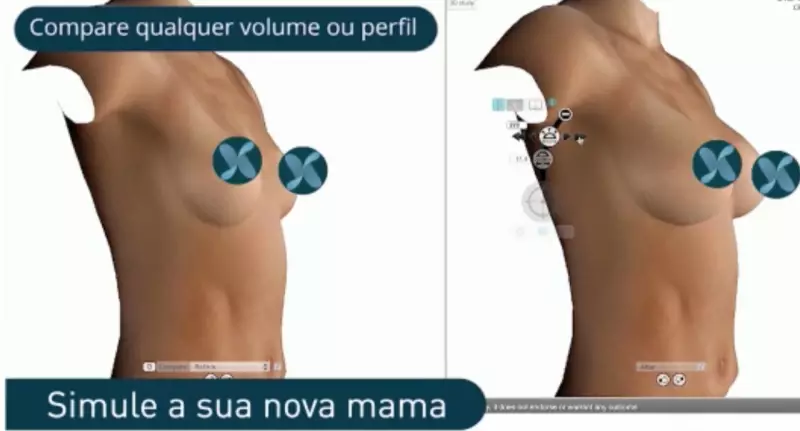 Cirurgias plásticas de mama ganham precisão com tecnologia 3D: veja como funciona