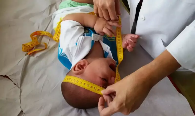 Congresso derruba veto e garante pensão vitalícia para vítimas do Zika vírus