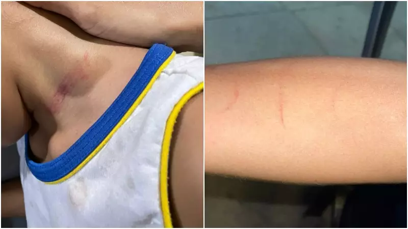 Criança com autismo e cardiopatia sofre agressão de cuidador em escola na Grande Fortaleza