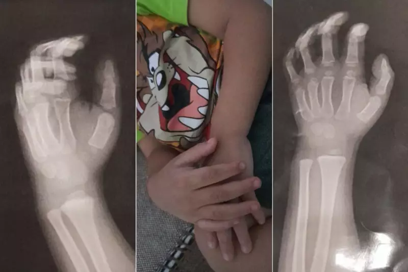 Criança de 3 anos agredida por professora tem medo de voltar à creche: 'Pesadelo', diz avó