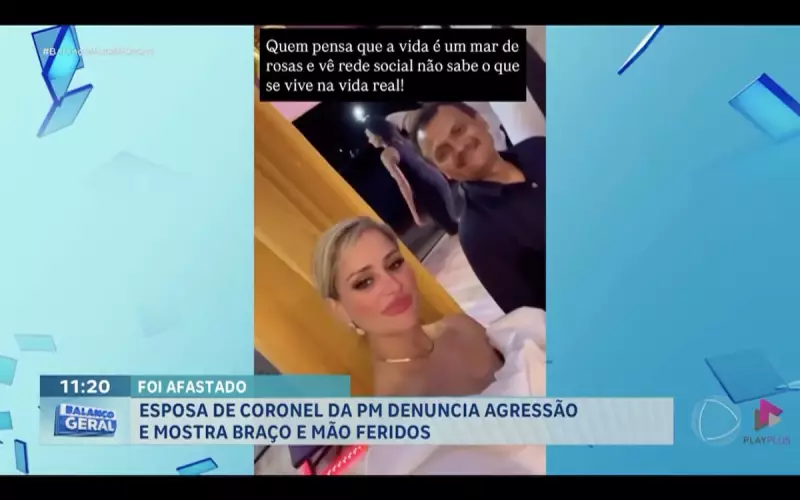 Esposa de coronel da PM denuncia agressão e mostra ferimentos em braço e mão