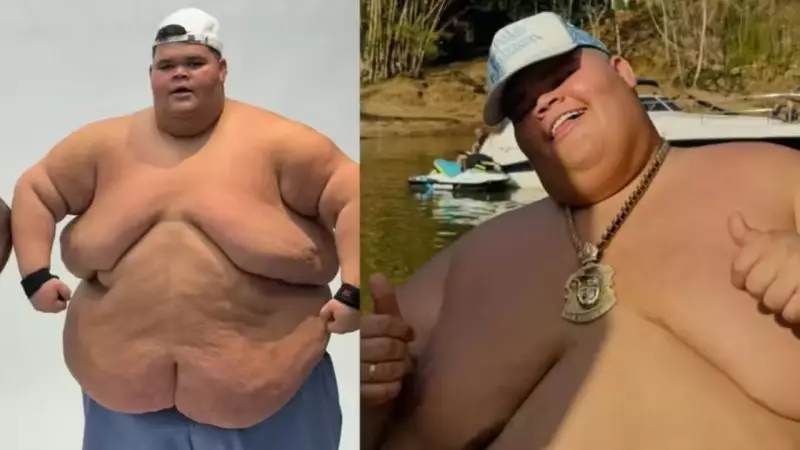 Ex-'Gordão da XJ' conquista vitória impressionante: perde 75 kg e agora sonha em andar de elevador