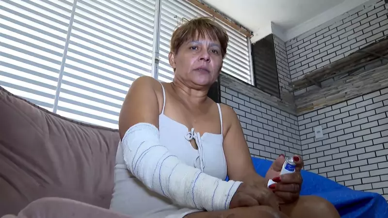 Feirante sofre queimaduras após barraca de pastel pegar fogo em Vila Velha: 'Poderia estar morta'