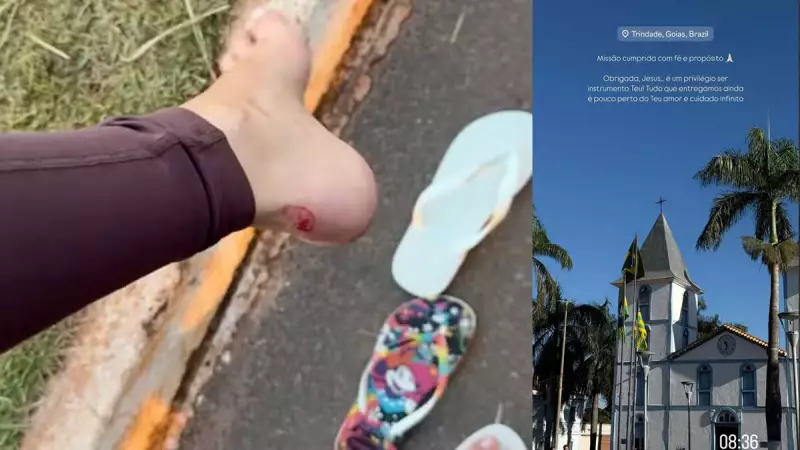 Gabriela Versiani mostra ferimentos após caminhada religiosa de 18 km em Mato Grosso