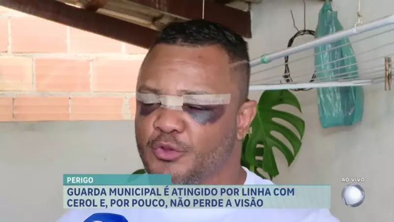 Guarda municipal é ferido por linha chilena enquanto pilotava moto na Grande BH